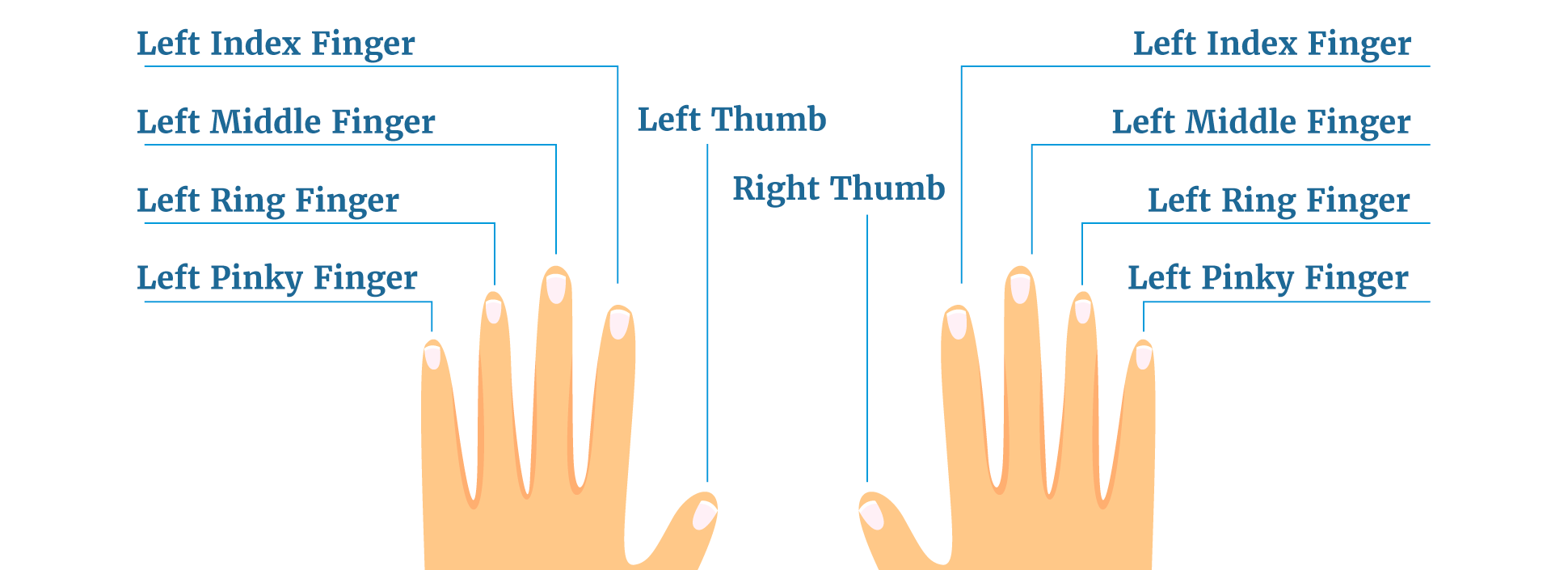 I am having pain in my right ring finger, going in my hand, what could it  be? - Quora